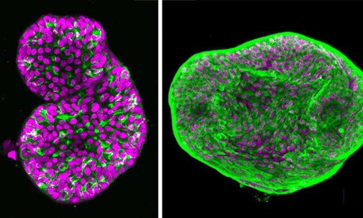 Two organoids from the Singh lab