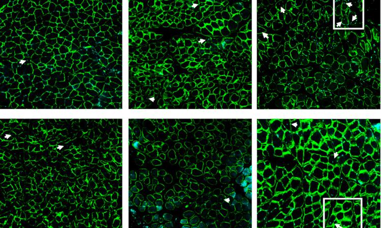 Six squares of green slides showing cells after a combination of mobilizing agent, designed to “push” pro-healing cells into the blood, and SDF-1a, designed to “pull” the cells into the injury site to boost muscle regeneration following a rotator cuff tear.